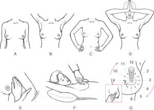 mellrák fizikai vizsgálat